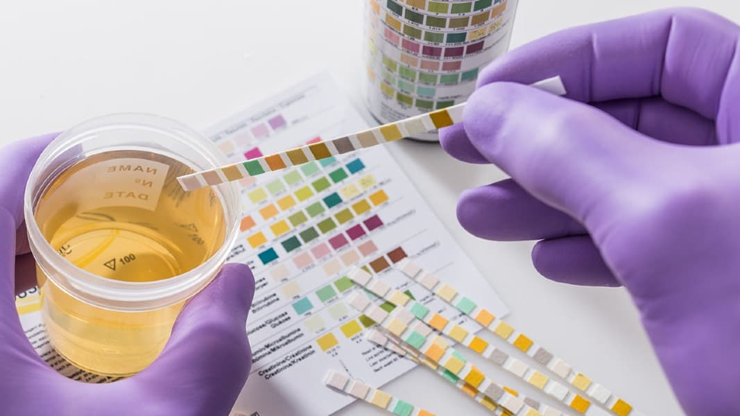 Drug Testing in Impaired Driving